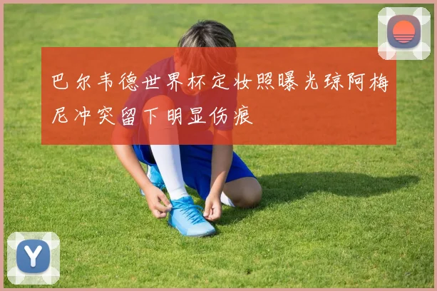 巴尔韦德世界杯定妆照曝光琼阿梅尼冲突留下明显伤痕